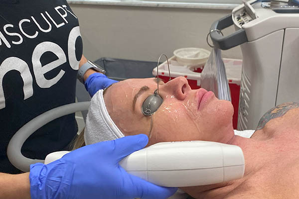 BBL Treatment performed on female patient face