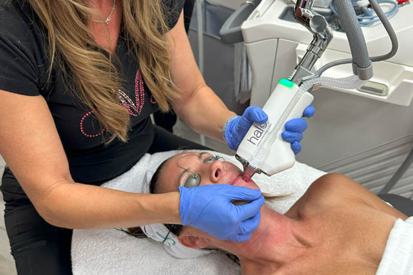 halo laser treatment performed on female patient face