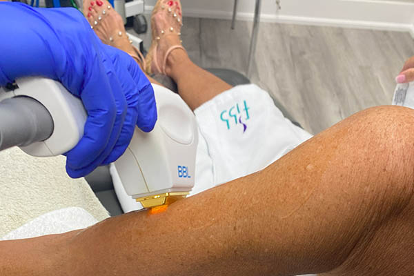 Skintyte treatment performed on patient's arm