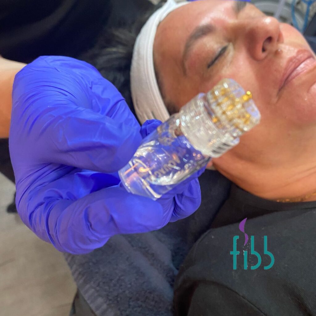 Aquagold treatment perform