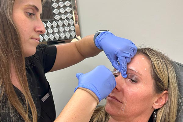 Botox injections on patient at FIBB Fort Myers office
