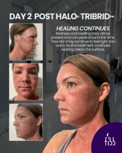 tribrid day 2