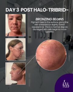 tribrid day 3