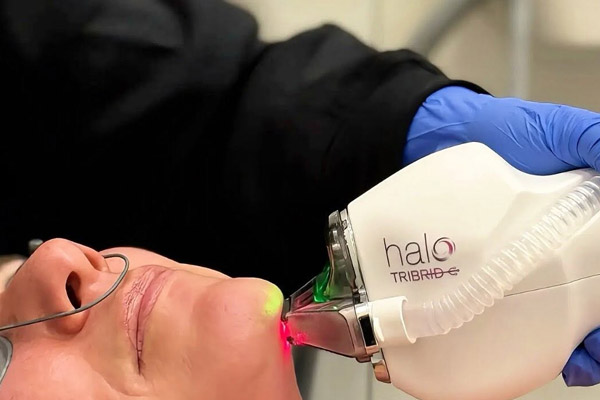 Halo Tribrid Treatment handpiece photo while performing treatment on patient
